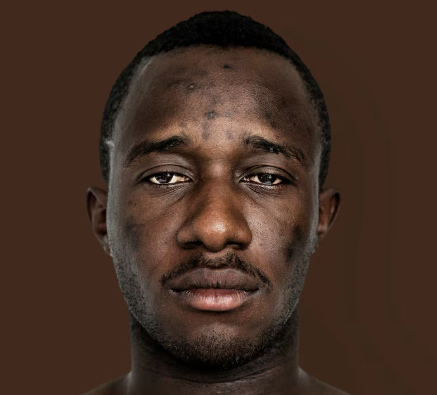 Igah Pascal